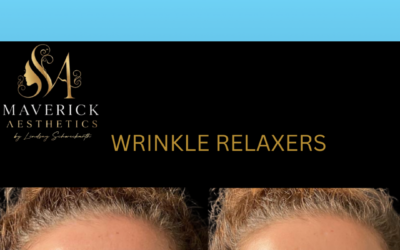 How Much Does Botox Cost in Pittsburgh? A Complete Guide to Botox Pricing